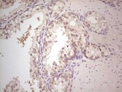 Immunohistochemistry: Hairless Antibody (OTI1D9) - Azide and BSA Free [NBP2-72023] - Analysis of Human prostate tissue. (Heat-induced epitope retrieval by Tris-EDTA, pH8.0)