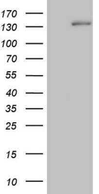 Western Blot: Hairless Antibody (OTI1D9) - Azide and BSA Free [NBP2-72023] - Analysis of HEK293T cells were transfected with the pCMV6-ENTRY control (Left lane) or pCMV6-ENTRY Hairless.