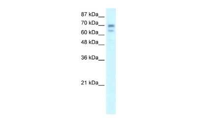 Western Blot: Hairless Antibody [NBP2-87553] - WB Suggested Anti-HR Antibody Titration: 0.2-1 ug/ml. ELISA Titer: 1:312500. Positive Control: HepG2 cell lysate