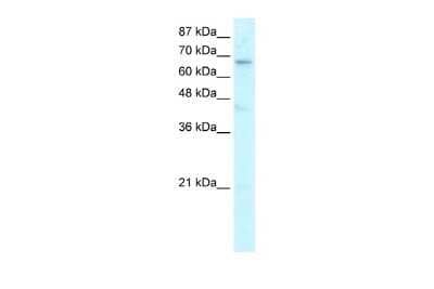 Western Blot: Hairless Antibody [NBP2-87554] - WB Suggested Anti-HR Antibody Titration: 0.2-1 ug/ml. Positive Control: HepG2 cell lysate