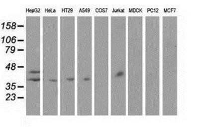 Western Blot: Haptoglobin Antibody (OTI4H5) - Azide and BSA Free [NBP2-70925] - Analysis of extracts (35ug) from 9 different cell lines by using anti-Haptoglobin monoclonal antibody.