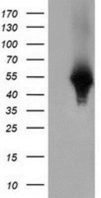 Western Blot: Haptoglobin Antibody (OTI4H5) - Azide and BSA Free [NBP2-70925] - HEK293T cells were transfected with the pCMV6-ENTRY control (Left lane) or pCMV6-ENTRY Haptoglobin (Right lane) cDNA for 48 hrs and lysed. Equivalent amounts of cell lysates (5 ug per lane) were separated by SDS-PAGE and immunoblotted with anti-Haptoglobi