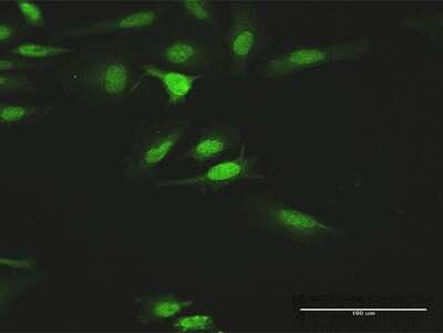 Immunocytochemistry/Immunofluorescence: Hck Antibody [H00003055-D01P] - Analysis of antibody to HCK on HeLa cell. Antibody concentration 10 ug/ml.