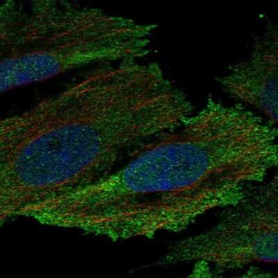 Immunocytochemistry/Immunofluorescence: Hck Antibody [NBP2-57211] - Staining of human cell line SiHa shows localization to nucleoplasm & plasma membrane.