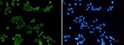 Immunocytochemistry/Immunofluorescence: Hck Antibody (S02-5C1) [NBP3-14957] - Immunocytochemistry of Hck (green) in hela using Hck Rabbit mAb at dilution 1/50, and DAPI (blue)