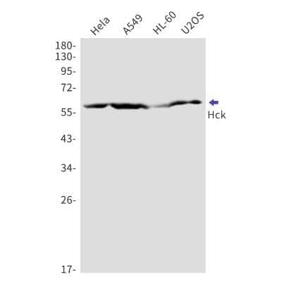 Western Blot: Hck Antibody (S02-5C1) [NBP3-14957] - Western blot detection of Hck in Hela, A549, HL-60, U2OS cell lysates using Hck Rabbit mAb (1:1000 diluted). Predicted band size: 60kDa. Observed band size: 60kDa.