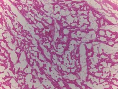 Hematoxylin & Eosin Stain: Heart Atrium Tissue Slides (Adult Normal Left) [NBP2-77545] - Tissue: Heart (left Atrium), Human, Normal