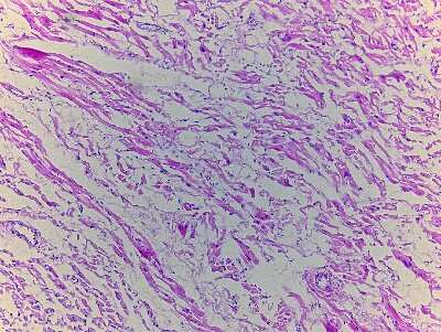 Hematoxylin & Eosin Stain: Heart Atrium Tissue Slides (Adult Normal Right) [NBP2-77784] - Tissue: Human Heart (right Atrium),  Pathology: Normal