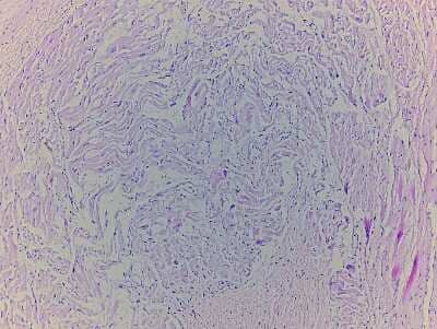 Hematoxylin & Eosin Stain: Heart Auricula Tissue Slides (Adult Normal Left) [NBP2-77785] - Tissue: Human Heart (left Auricula),  Pathology: Normal