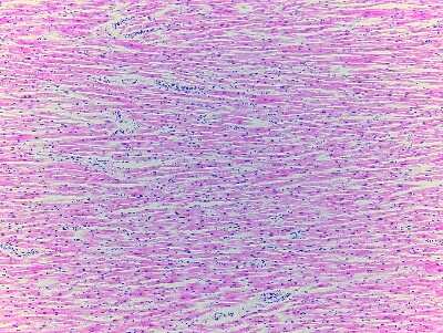 Hematoxylin & Eosin Stain: Heart Papilla Muscle Tissue Slides (Adult Normal) [NBP2-77789] - Tissue: Human Heart (Papilla Muscle),  Pathology: Normal