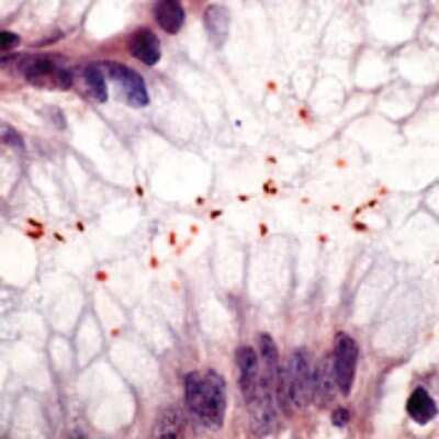 Immunohistochemistry-Paraffin: Helicobacter Pylori Antibody [NB120-7788] - Formalin fixed paraffin embedded human stomach infected with H. pylori and stained with H. pylori antibody.