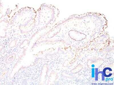 Immunohistochemistry-Paraffin: Helicobacter Pylori Antibody [NBP2-29479] - Formalin-fixed, paraffin-embedded human stomach stained with Helicobacter pylori antibody (1:200), peroxidase-conjugate and DAB chromogen.    Staining of formalin-fixed tissues requires boiling tissue sections in citrate buffer, pH 6, or 1 mM EDTA, pH 8.0 for 10-20 min followed by cooling at RT for 20 min. Both methods allow for suitable detection, however using EDTA is the superior method.