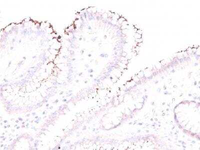 Immunohistochemistry-Paraffin: Helicobacter Pylori Antibody [NBP2-29479] - Formalin-fixed. paraffin-embedded human stomach stained with helicobacter pylori rabbit polyclonal antibody.