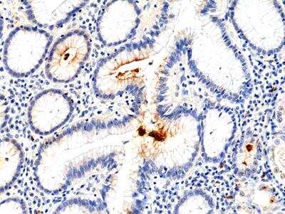 Immunohistochemistry-Paraffin: Helicobacter Pylori Antibody (RM400) [NBP2-89094] - Immunohistochemical staining of formalin fixed and paraffin embedded human stomach using Anti-H.Pylori Rabbit Monoclonal Antibody (Clone RM400) at a 1:100 dilution.