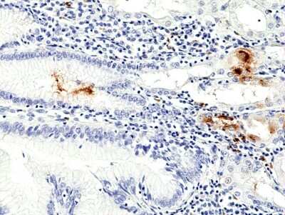 Immunohistochemistry-Paraffin: Helicobacter Pylori Antibody (RM429) [NBP3-09179] - Immunohistochemical staining of formalin fixed and paraffin embedded human stomach using NBP3-09179 at a 1:100 dilution.