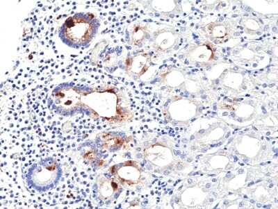 Immunohistochemistry-Paraffin: Helicobacter Pylori Antibody (RM429) [NBP3-09179] - Immunohistochemical staining of formalin fixed and paraffin embedded human stomach using NBP3-09179 at a 1:100 dilution.