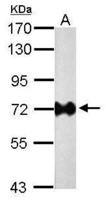 Western Blot Helicobacter pylori urease B Antibody (1263) - Azide and BSA Free