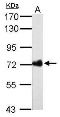 Western Blot Helicobacter pylori urease B Antibody (962)