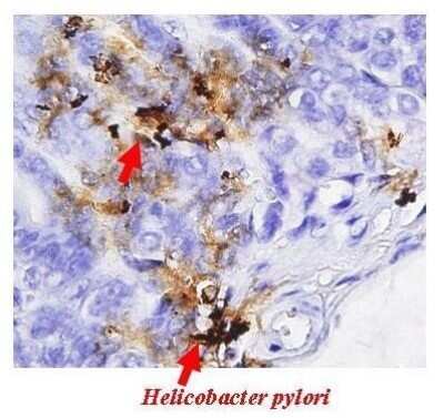 Immunohistochemistry-Paraffin: Helicobacter pylori urease B Antibody [NBP2-42850] - Analysis of mice Gastric pylori, using Helicobacter pylori urease B antibody at 1:500 dilution.