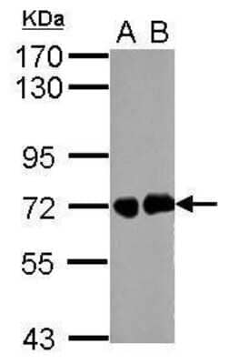 Western Blot: Helicobacter pylori urease B Antibody [NBP2-42850] - Analysis of whole cell lysate. A: helicobacter pylori (0.5ug) B: helicobacter pylori (1ug) 7.5% SDS PAGE diluted at 1:5000.0.