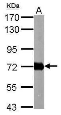 Western Blot Helicobacter pylori urease B Antibody