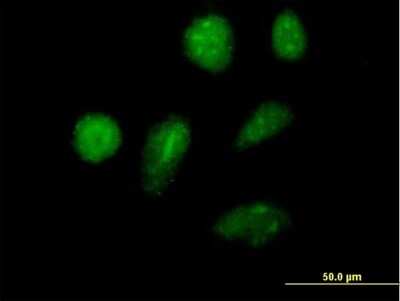 Immunocytochemistry/Immunofluorescence: Helios Antibody [H00022807-B01P] - Analysis of purified antibody to ZNFN1A2 on HeLa cell. (antibody concentration 10 ug/ml)