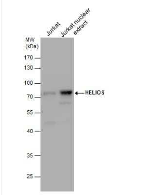 Western Blot: Helios Antibody [NBP2-16802] - Jurkat whole cell extracts and nuclear extracts (30 ug) were separated by 10% SDS-PAGE, and the membrane was blotted with HELIOS antibody  diluted by 1:500 and developed with Trident Sharp-ECL.