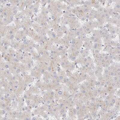 Immunohistochemistry: Hematopoietic Prostaglandin D Synthase/HPGDS Antibody [NBP1-83322] - Staining of human liver shows no positivity in hepatocytes as expected.