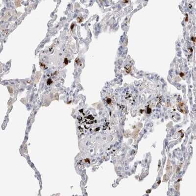 Immunohistochemistry-Paraffin: Hematopoietic Prostaglandin D Synthase/HPGDS Antibody [NBP1-83322] - Staining of human lung shows high expression.