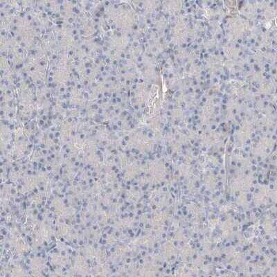 Immunohistochemistry-Paraffin: Hematopoietic Prostaglandin D Synthase/HPGDS Antibody [NBP1-83322] - Staining of human pancreas shows low expression as expected.