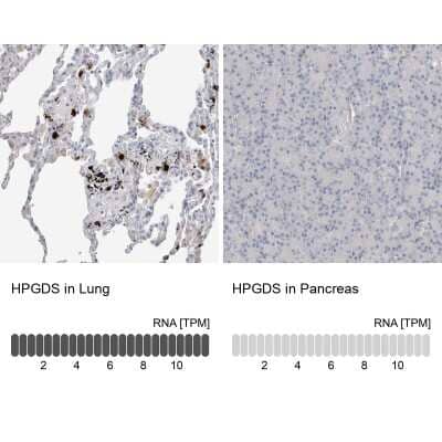 <b>Orthogonal Strategies Validation. </b>Immunohistochemistry-Paraffin: Hematopoietic Prostaglandin D Synthase/HPGDS Antibody [NBP1-83322] - Staining in human lung and pancreas tissues using anti-HPGDS antibody. Corresponding HPGDS RNA-seq data are presented for the same tissues.