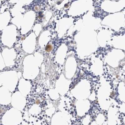 Immunohistochemistry-Paraffin: Hematopoietic Prostaglandin D Synthase/HPGDS Antibody [NBP1-83322] - Staining of human bone marrow shows moderate cytoplasmic positivity in megakaryocytes.