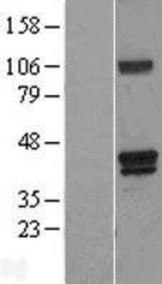 Western Blot: Heme oxygenase 2 Overexpression Lysate (Adult Normal) [NBL1-11625] Left-Empty vector transfected control cell lysate (HEK293 cell lysate); Right -Over-expression Lysate for Heme oxygenase 2.