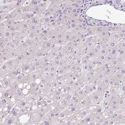 Immunohistochemistry-Paraffin Hemicentin 2 Antibody