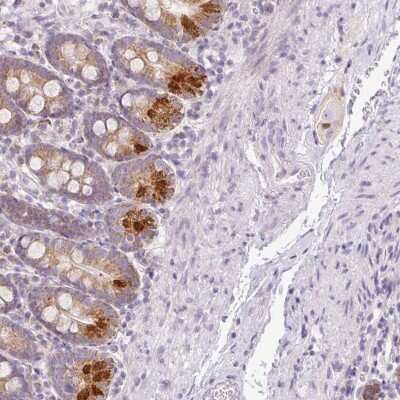 Immunohistochemistry-Paraffin Hemicentin 2 Antibody