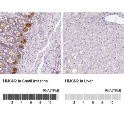 Immunohistochemistry-Paraffin Hemicentin 2 Antibody