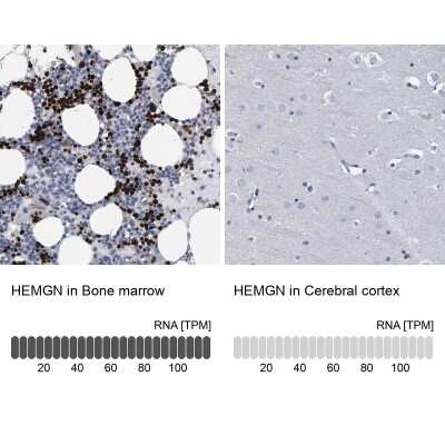<b>Orthogonal Strategies Validation. </b>Immunohistochemistry-Paraffin: Hemogen Antibody [NBP1-84909] - Analysis in human bone marrow and cerebral cortex tissues. Corresponding HEMGN RNA-seq data are presented for the same tissues.