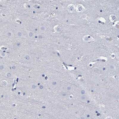 Immunohistochemistry-Paraffin: Hemogen Antibody [NBP1-84909] - Staining of human cerebral cortex shows no positivity in neurons as expected.