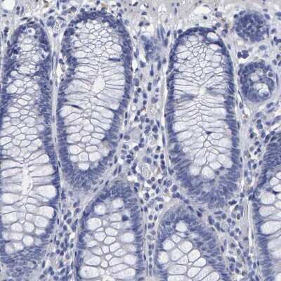 Immunohistochemistry-Paraffin: Hemogen Antibody [NBP1-84909] - Staining of human colon shows no positivity in glandular cells as expected.