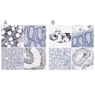 <b>Independent Antibodies Validation. </b>Immunohistochemistry-Paraffin: Hemogen Antibody [NBP1-84909] - Staining of human bone marrow, colon, kidney and testis using Anti-HEMGN antibody (A) NBP1-84909 shows similar protein distribution across tissues to independent antibody NBP1-84908 (B).