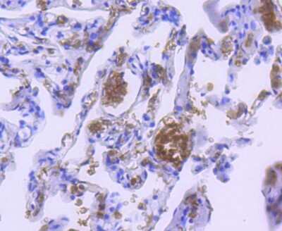Immunohistochemistry-Paraffin: Hemoglobin A1 Antibody (SN70-09) [NBP2-67716] - Analysis of paraffin-embedded human lung tissue using anti-Hemoglobin subunit alpha antibody. Counter stained with hematoxylin.