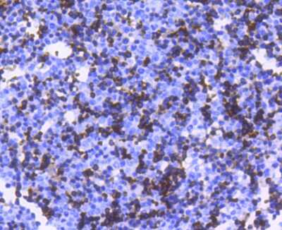 Immunohistochemistry-Paraffin: Hemoglobin A1 Antibody (SN70-09) [NBP2-67716] - Analysis of paraffin-embedded mouse embryo tissue using anti-Hemoglobin subunit alpha antibody. Counter stained with hematoxylin.