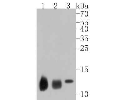 Western Blot: Hemoglobin A1 Antibody (SN70-09) [NBP2-67716] - Western blot analysis of Hemoglobin A1 on different lysates. Proteins were transferred to a PVDF membrane and blocked with 5% BSA in PBS for 1 hour at room temperature. The primary antibody (1/500) was used in 5% BSA at room temperature for 2 hours. Goat
