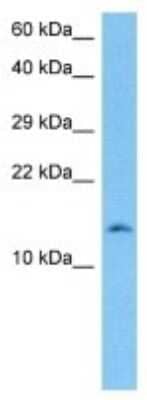 Western Blot: Hemoglobin beta 2 Antibody [NBP3-10143] - Western blot analysis of Hemoglobin beta 2 in Mouse Brain lysates. Antibody dilution at 1ug/ml