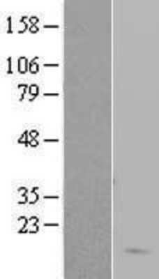 Western Blot: Hemoglobin delta Overexpression Lysate (Adult Normal) [NBL1-11457] Left-Empty vector transfected control cell lysate (HEK293 cell lysate); Right -Over-expression Lysate for Hemoglobin delta.