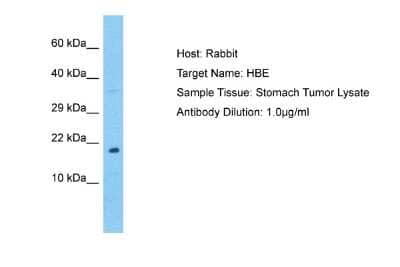 Western Blot: Hemoglobin epsilon Antibody [NBP2-84061] - WB Suggested Anti-HBE antibody Titration: 1 ug/mL. Sample Type: Human Stomach Tumor