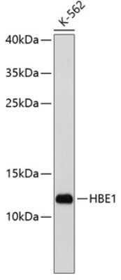 Western Blot: Hemoglobin epsilon Antibody [NBP3-03279] - Analysis of extracts of K-562 cells, using Hemoglobin epsilon antibody at 1:1000 dilution. Secondary antibody: HRP Goat Anti-Rabbit IgG (H+L) at 1:10000 dilution. Lysates/proteins: 25ug per lane. Blocking buffer: 3% nonfat dry milk in TBST.