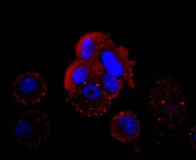 Immunocytochemistry/Immunofluorescence: HBG1/2 Antibody (JM84-10) [NBP2-66885] - Hemoglobin gamma A Antibody (JM84-10) [NBP2-66885] - Staining HBG1/2 in MCF-7 cells (red). The nuclear counter stain is DAPI (blue). Cells were fixed in paraformaldehyde, permeabilised with 0.25% Triton X100/PBS.