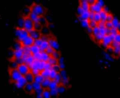 Immunocytochemistry/Immunofluorescence: HBG1/2 Antibody (JM84-10) [NBP2-66885] - Staining HBG1/2 in D3 cells (red). The nuclear counter stain is DAPI (blue). Cells were fixed in paraformaldehyde, permeabilised with 0.25% Triton X100/PBS.