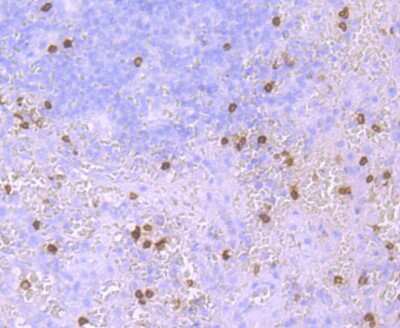 Immunohistochemistry-Paraffin: HBG1/2 Antibody (JM84-10) [NBP2-66885] - Analysis of paraffin-embedded human spleen tissue using anti-HBG1/2 antibody. Counter stained with hematoxylin.